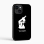 כיסוי בעיצוב אישי עם השם שלך לדגם - Apple iPhone 16 בעיצוב מיקרוסקופ