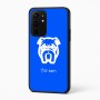 כיסוי בעיצוב אישי עם השם שלך לדגם - Realme 16 Pro+ 5G בעיצוב פרצוף בולדוג