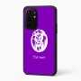 כיסוי בעיצוב אישי עם השם שלך לדגם - Realme 16 Pro+ 5G בעיצוב פני אריה