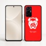 כיסוי בעיצוב אישי עם השם שלך לדגם - Realme 16 Pro+ 5G בעיצוב פרצוף בולדוג